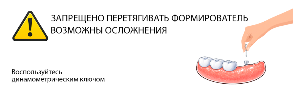 Gingival-formulator-and-its-retraction.png Gingival-formulator-and-its-retraction.png